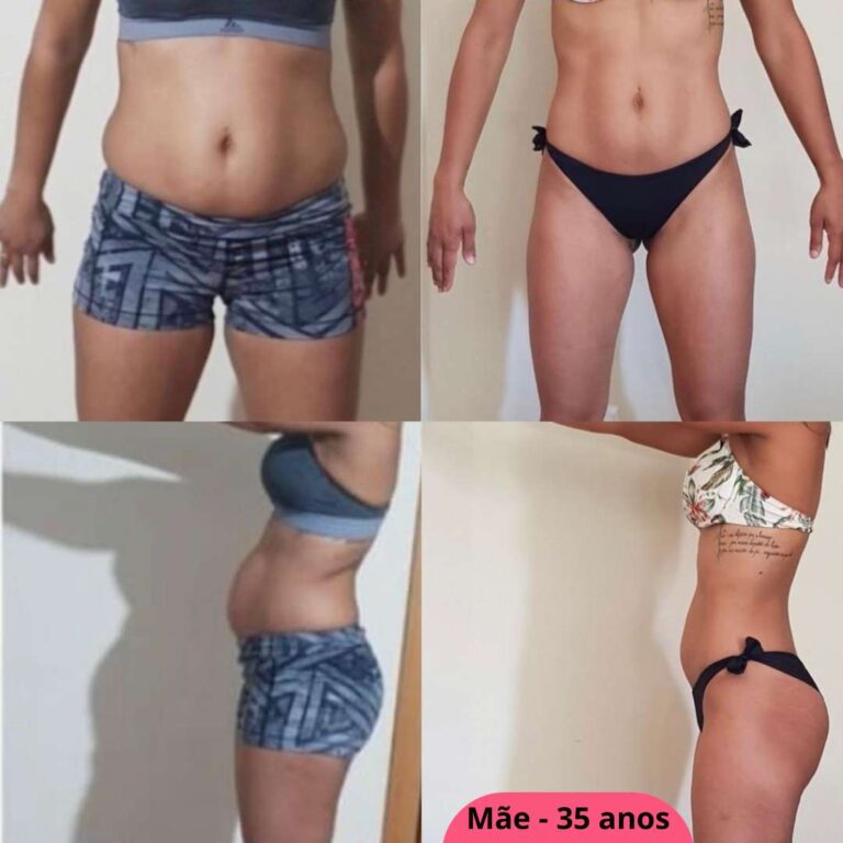 40 anos